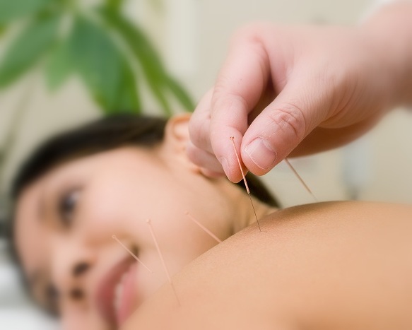 How Acupuncture Can Rejuvenate Your Skin